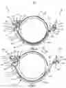 Fig. 09 - Apparatus and method for effecting movement and clearance spacing of a concave