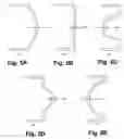 Fig. 05 - Polymer composite baseball bat endcap
