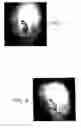 Fig. 06 - Peptides with wound healing activity