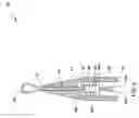 Fig. 05 - Systems and methods relating to associating a medical implant with a delivery device