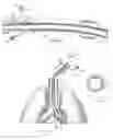 Fig. 02 - Endotracheal camera