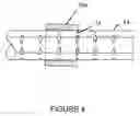 Fig. 05 - Retractor