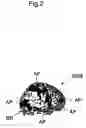 Fig. 03 - Method for mapping higher brain function and headgear for mapping higher brain function