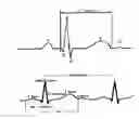 Fig. 02 - System and a method for analyzing ECG curvature