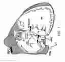 Fig. 09 - Method and system of increasing safety of cardiac ablation procedures