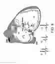 Fig. 10 - Method and system of increasing safety of cardiac ablation procedures