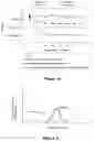 Fig. 03 - Cognition and motor timing diagnosis and training system and method