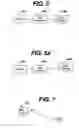 Fig. 06 - System and method for urodynamic evaluation utilizing micro-electronic mechanical system