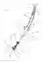 Fig. 03 - Guidewire system with a deflectable distal tip