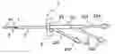 Fig. 01 - Multi lumen catheter