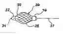 Fig. 01 - Drainage catheter having an expandable retention member