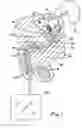 Fig. 02 - Drainage catheter having an expandable retention member
