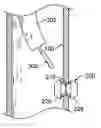 Fig. 01 - Methods and devices for maintaining patency of surgically created channels in a body organ