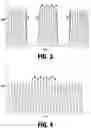 Fig. 04 - Method and system for photoselective vaporization for gynecological treatments