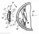 Fig. 01 - Method and apparatus for reshaping the cornea by controlled thermal delivery