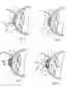 Fig. 05 - Method and apparatus for reshaping the cornea by controlled thermal delivery