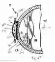 Fig. 08 - Method and apparatus for reshaping the cornea by controlled thermal delivery