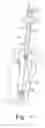 Fig. 05 - Minimally invasive orthopaedic apparatus and methods