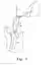 Fig. 06 - Minimally invasive orthopaedic apparatus and methods