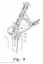 Fig. 09 - Minimally invasive orthopaedic apparatus and methods
