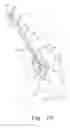 Fig. 13 - Minimally invasive orthopaedic apparatus and methods