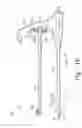Fig. 16 - Minimally invasive orthopaedic apparatus and methods
