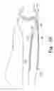 Fig. 24 - Minimally invasive orthopaedic apparatus and methods