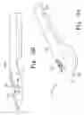 Fig. 28 - Minimally invasive orthopaedic apparatus and methods