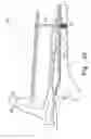 Fig. 35 - Minimally invasive orthopaedic apparatus and methods