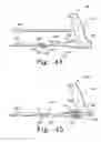 Fig. 40 - Minimally invasive orthopaedic apparatus and methods