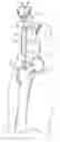 Fig. 01 - Minimally invasive orthopaedic apparatus and methods