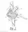 Fig. 02 - Minimally invasive orthopaedic apparatus and methods
