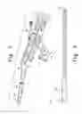 Fig. 07 - Minimally invasive orthopaedic apparatus and methods
