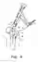 Fig. 09 - Minimally invasive orthopaedic apparatus and methods