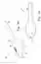 Fig. 22 - Minimally invasive orthopaedic apparatus and methods