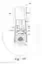 Fig. 33 - Minimally invasive orthopaedic apparatus and methods