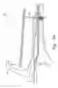 Fig. 35 - Minimally invasive orthopaedic apparatus and methods