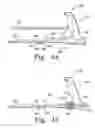 Fig. 40 - Minimally invasive orthopaedic apparatus and methods