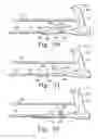 Fig. 43 - Minimally invasive orthopaedic apparatus and methods
