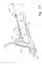Fig. 44 - Minimally invasive orthopaedic apparatus and methods
