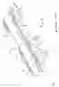 Fig. 02 - Dynamic cervical plate