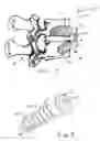 Fig. 02 - Static anterior cervical plate