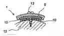 Fig. 01 - Supporting element for attachment to bone