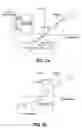 Fig. 04 - Mounting mechanisms for pedicle screws and related assemblies