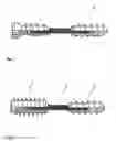 Fig. 03 - Implantable screw for stabilization of a joint or a bone fracture