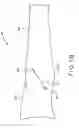 Fig. 03 - Method and apparatus for performing a minimally invasive total hip arthroplasty