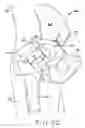 Fig. 06 - Method and apparatus for performing a minimally invasive total hip arthroplasty