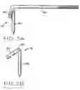 Fig. 09 - Method and apparatus for performing a minimally invasive total hip arthroplasty