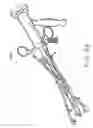 Fig. 34 - Method and apparatus for performing a minimally invasive total hip arthroplasty