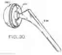 Fig. 35 - Method and apparatus for performing a minimally invasive total hip arthroplasty